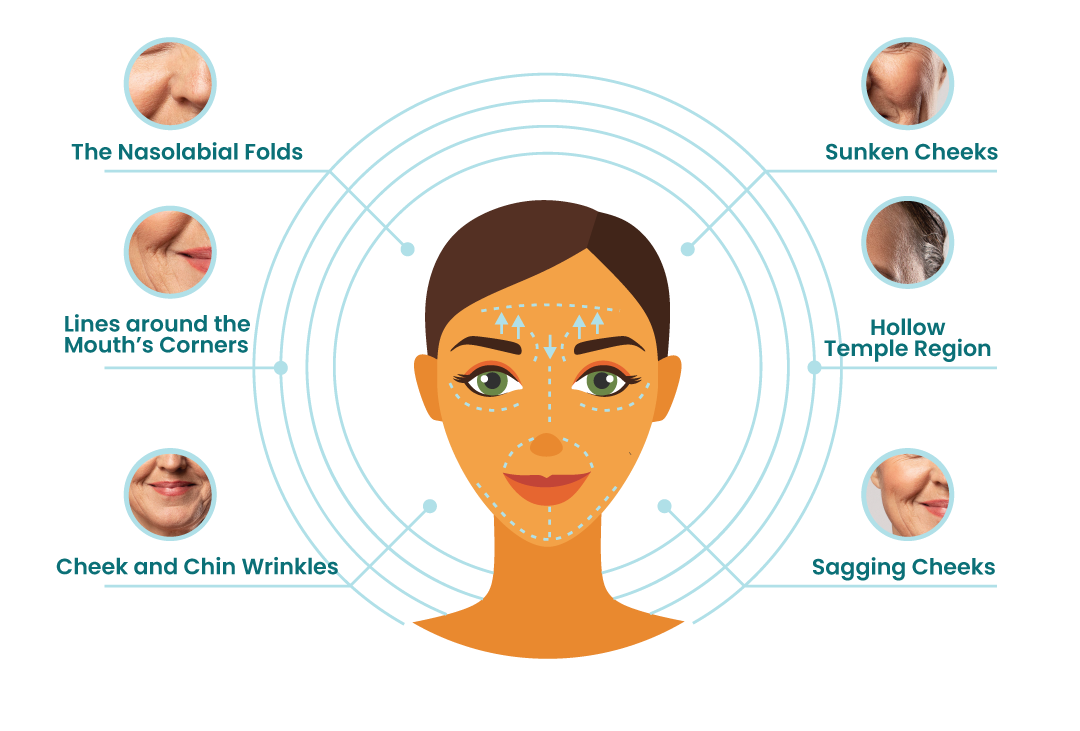SCULPTRA-FACE.png